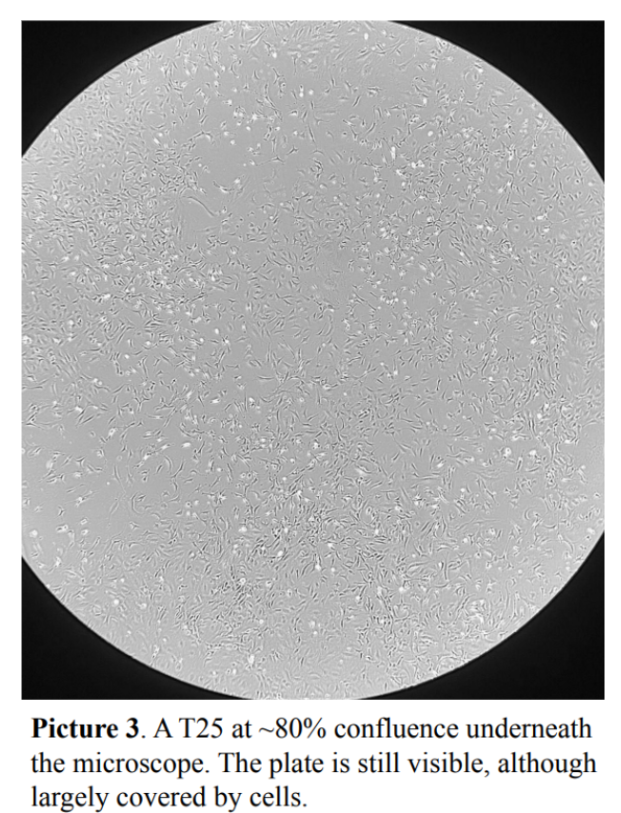 Picture 3. A T25 at ~80% confluence underneath the microscope.