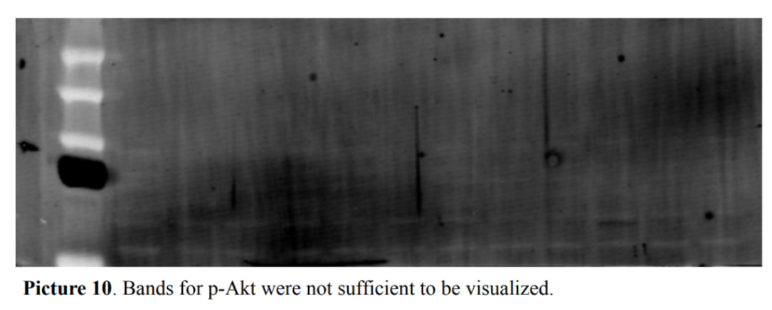 Picture 10. Bands for p-Akt were not sufficient to be visualized.